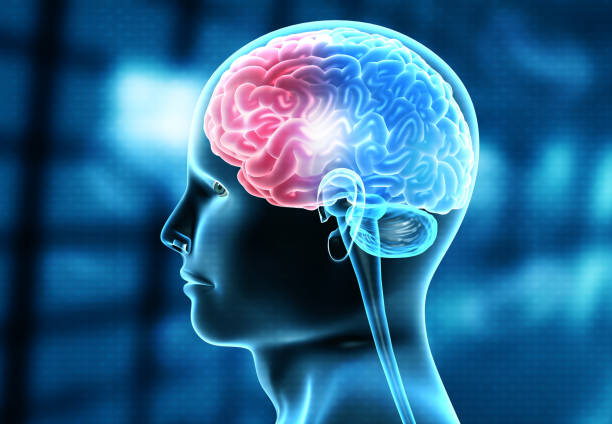 Brain stroke treatment in gr noida