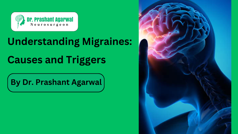 Migraines: Causes and Triggers