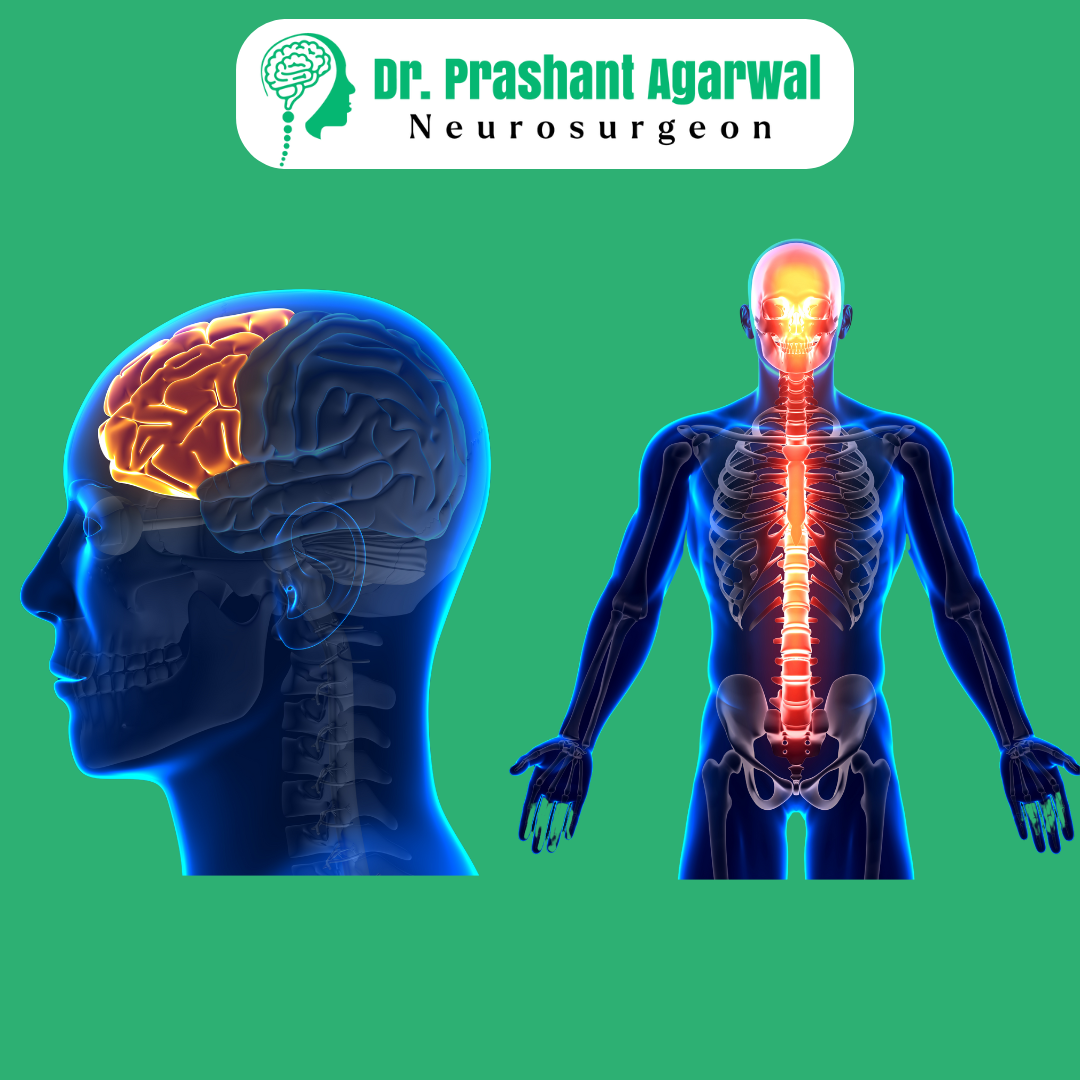 Best Brain and Spine Specialist
