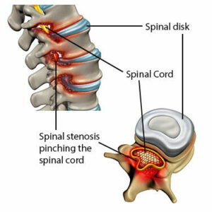 Best Spine Doctor in Greater Noida