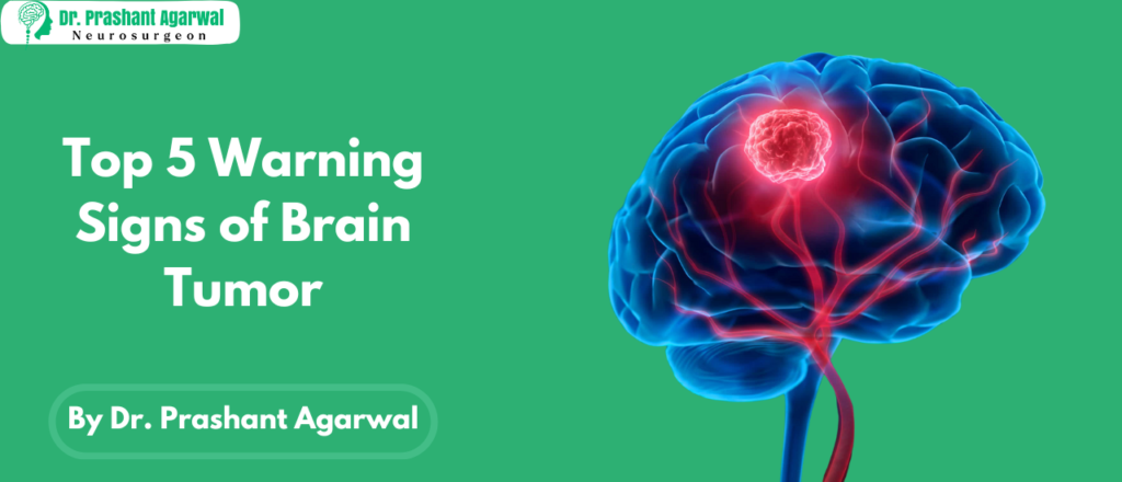 Top 5 Warning Signs of Brain Tumor