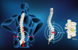 Best Vrain and Spine Clinic in Greater Noida