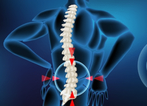 Best Slip disc specialist in Greater Noida