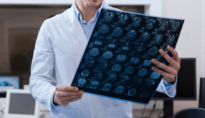 Best Brain stroke specialist in Greater Noida