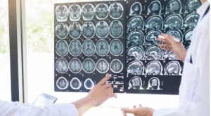 Best Brain and spine specialist in Greater Noida
