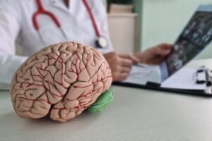 Best Brain Specialist in Noida