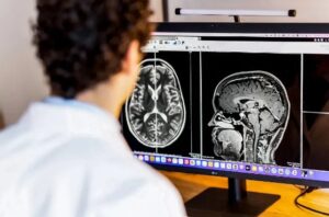 Best Neuro Specialist in Noida