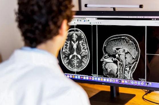 Best Neuro Specialist in Noida