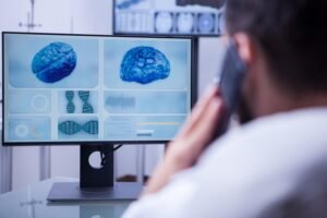 Best Brain Stroke Specialist in Noida